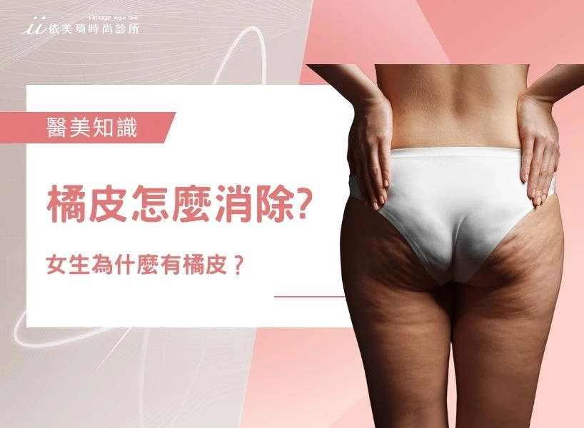 女生為什麼有橘皮?橘皮怎麼消除??醫美改善+日常對策一次看