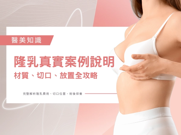 台南隆乳推薦 : 隆乳類型、材質、切口、放置、案例分享