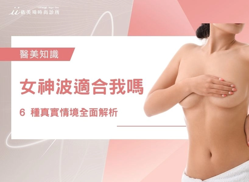 「 繆思女神波適合我嗎? 」6 種真實情境全面解析|醫師教你怎麼選