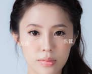 是臥蟬還是眼袋？