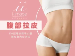 腹部拉皮手術推薦