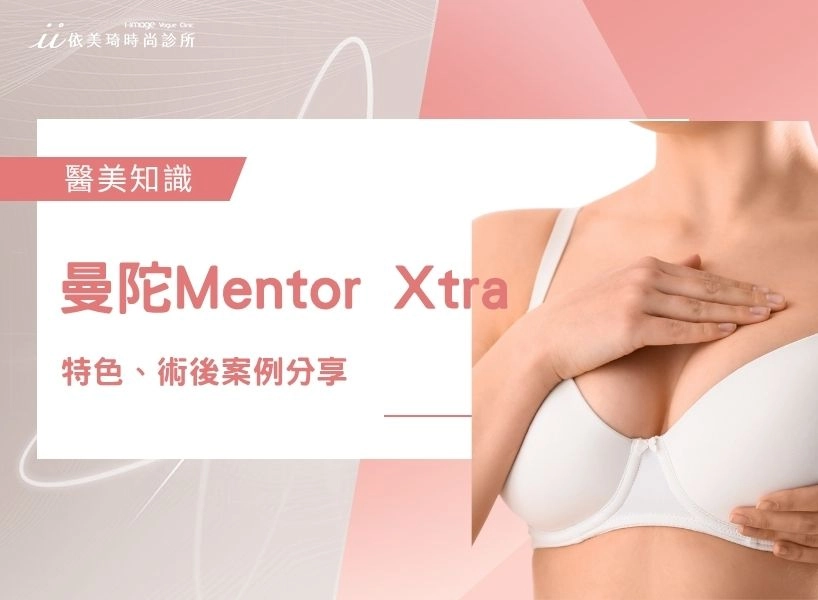 曼陀Mentor Xtra價格貴嗎 ? 曼陀Mentor Xtra特色、術後案例分享 ? 什麼是 AI 精準填充＋高塑形