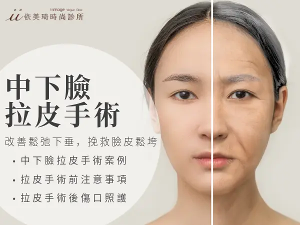 中下臉拉皮手術