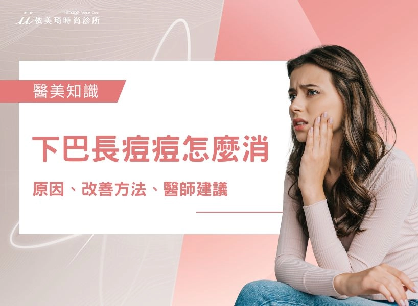 下巴長痘痘怎麼消?下巴長痘痘原因、改善方法與醫師建議