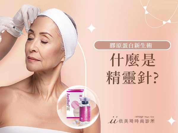 精靈針 AestheFill 艾麗斯