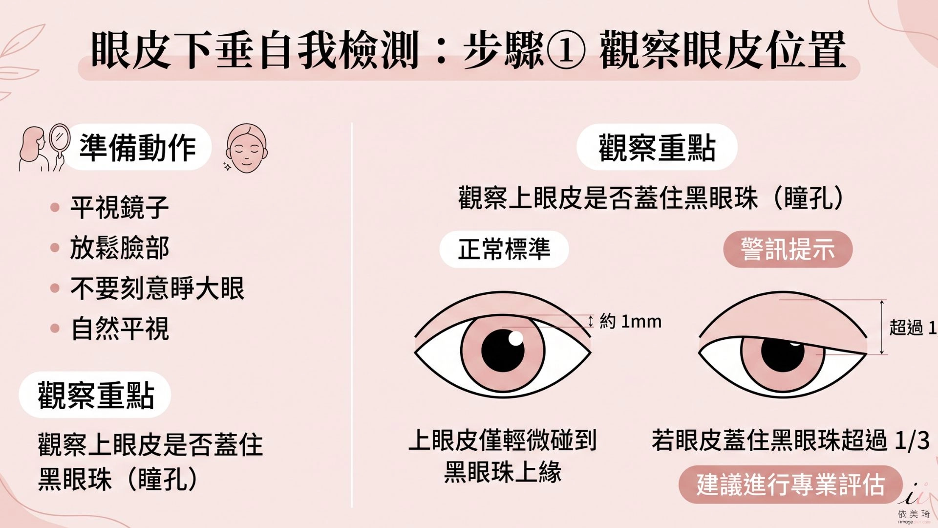 步驟① 平視鏡子，觀察眼皮位置