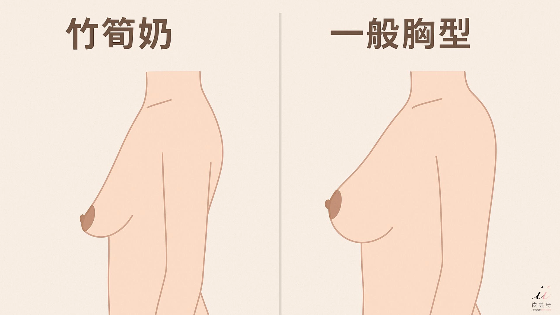 我是「 竹筍奶 」嗎