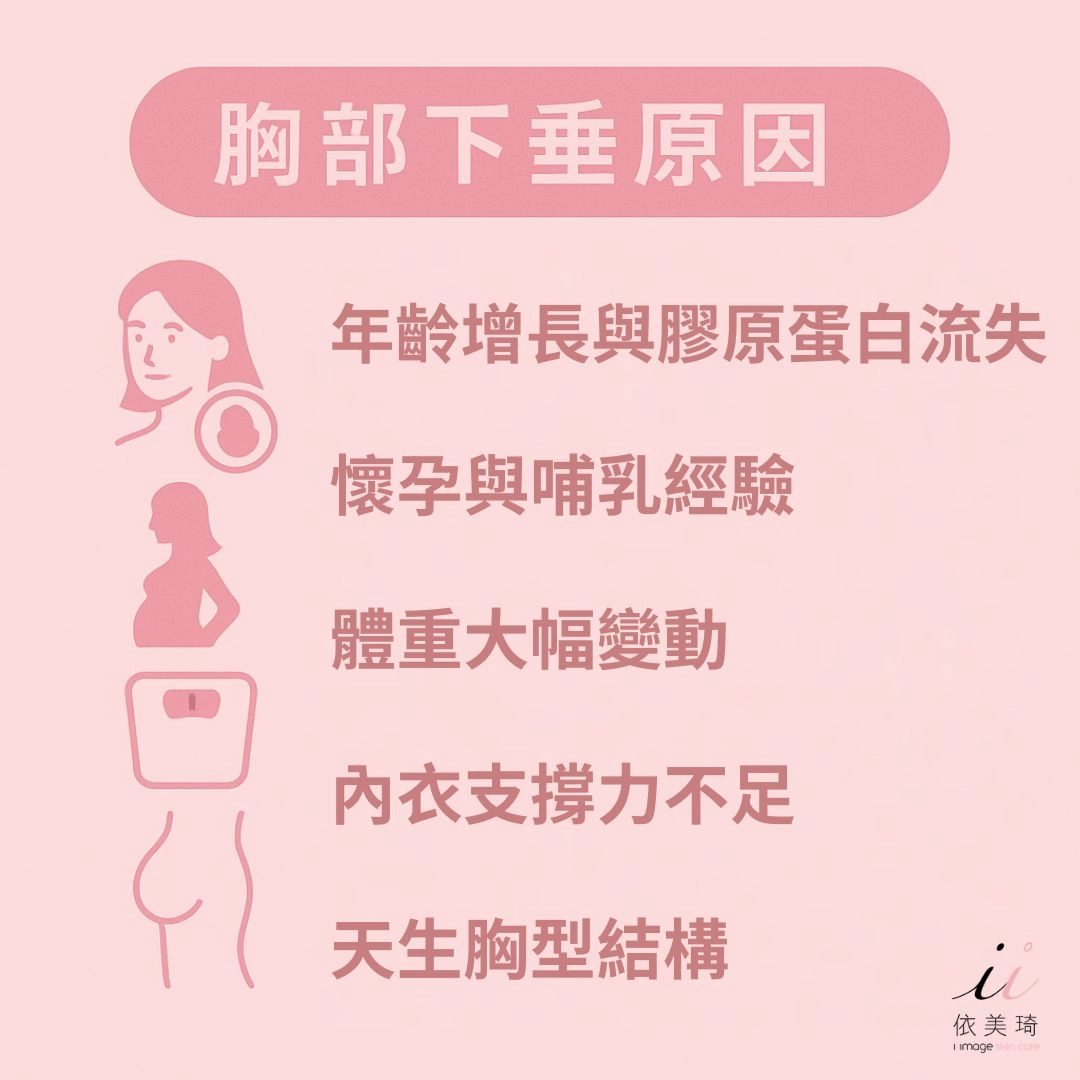胸部下垂原因