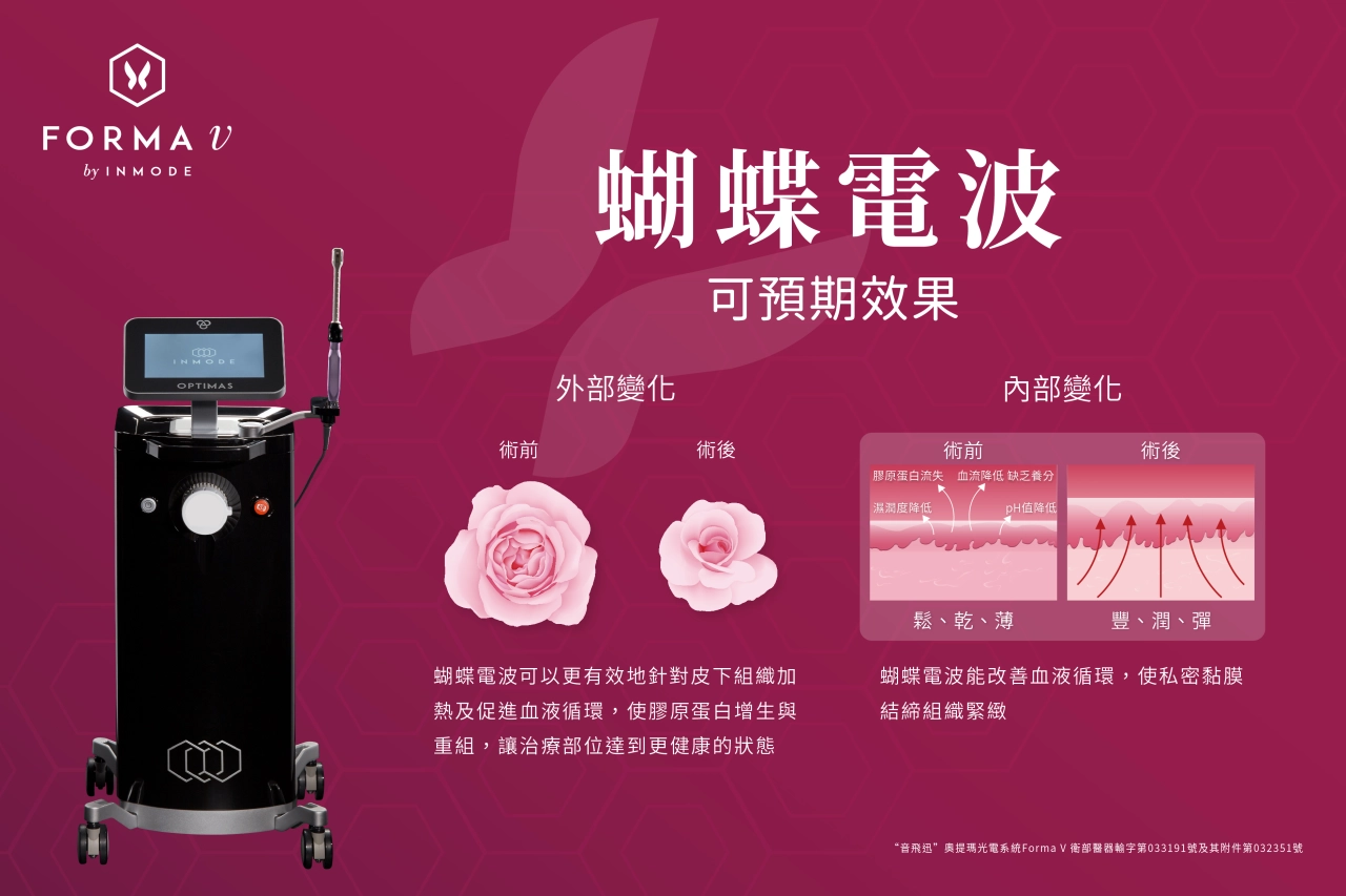 蝴蝶電波可預期效果