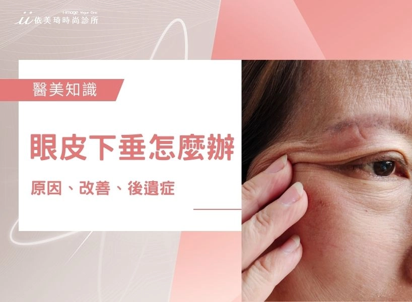 眼皮下垂怎麼辦？眼皮下垂原因、改善與手術後遺症一次看！