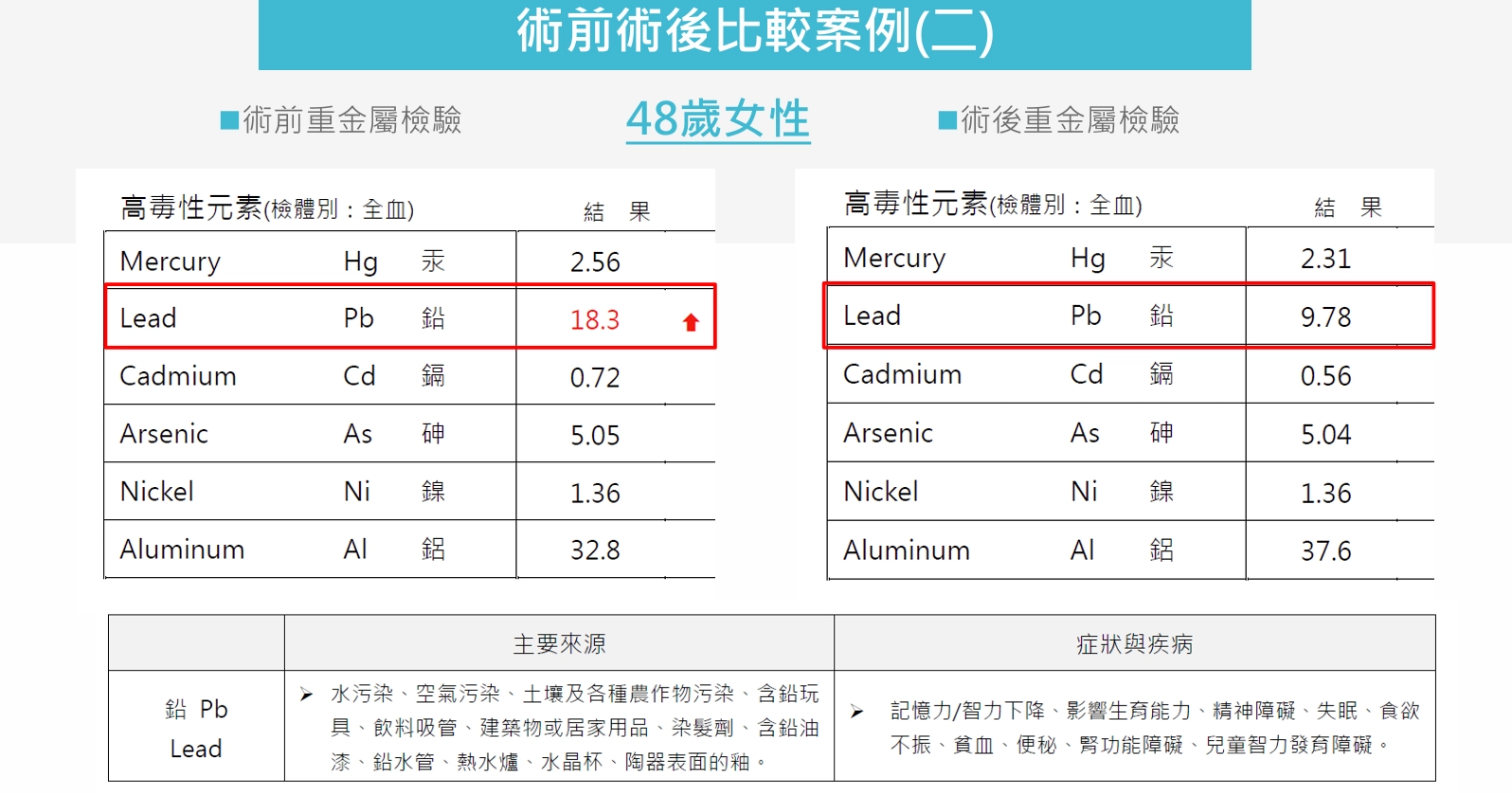 術前術後比較案例