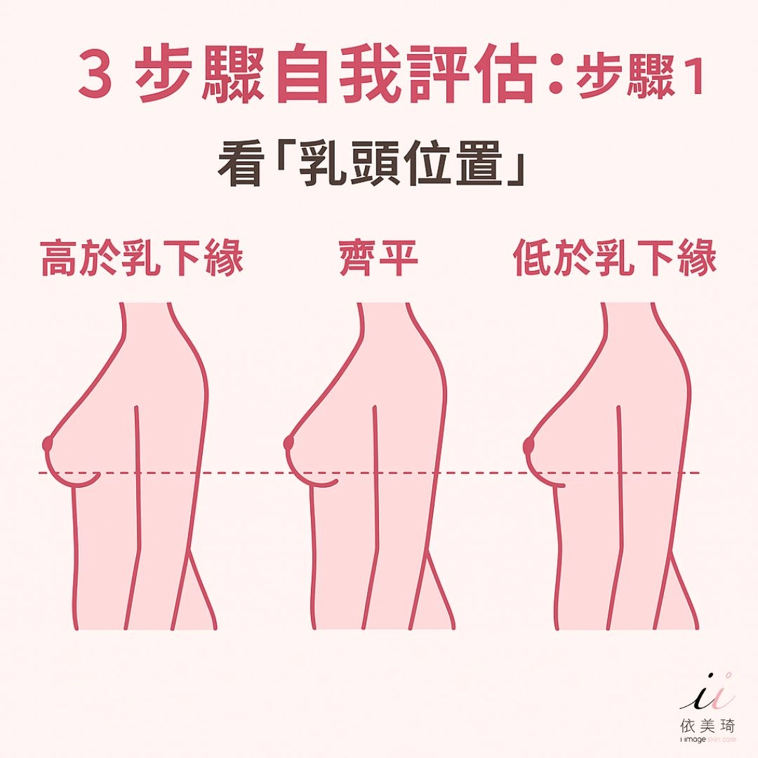布袋奶自我評估