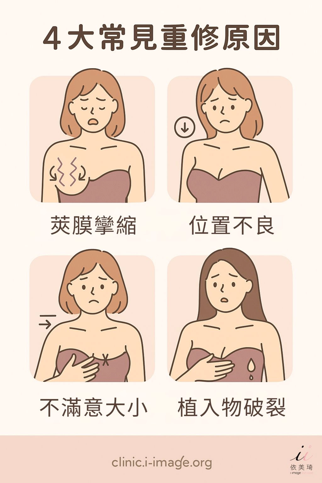 二次隆乳原因