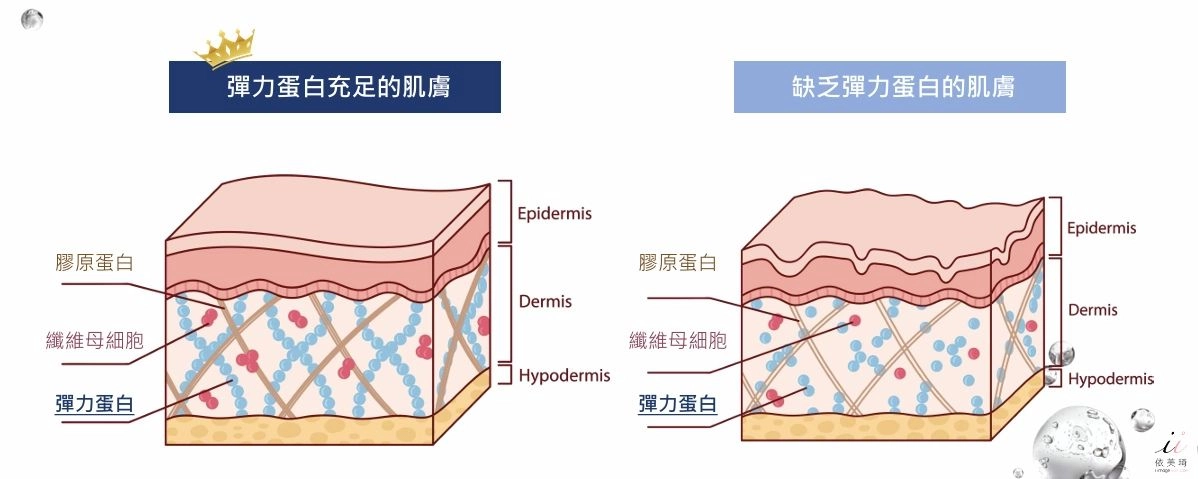 彈力蛋白與膠原蛋白