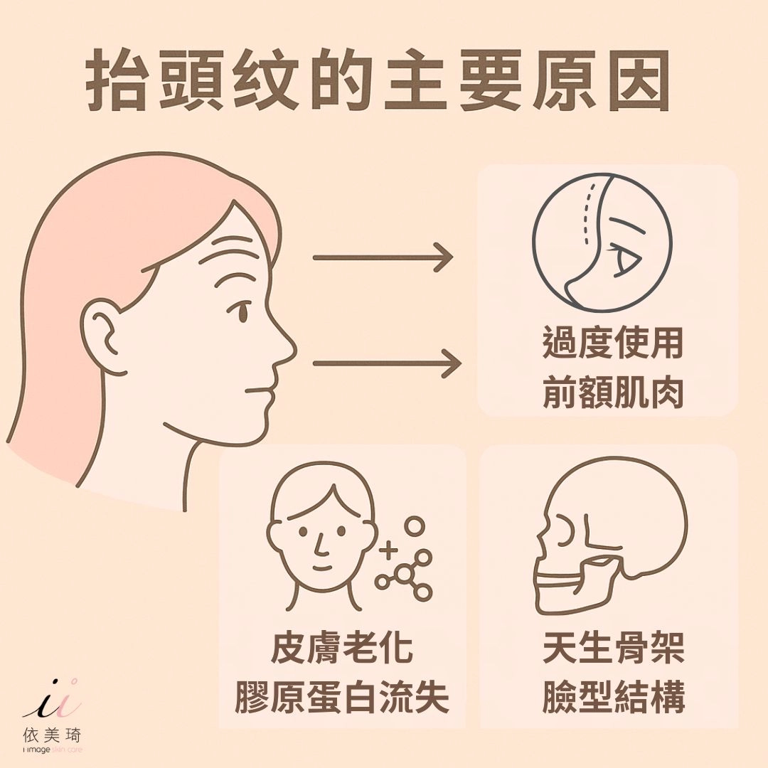抬頭紋原因