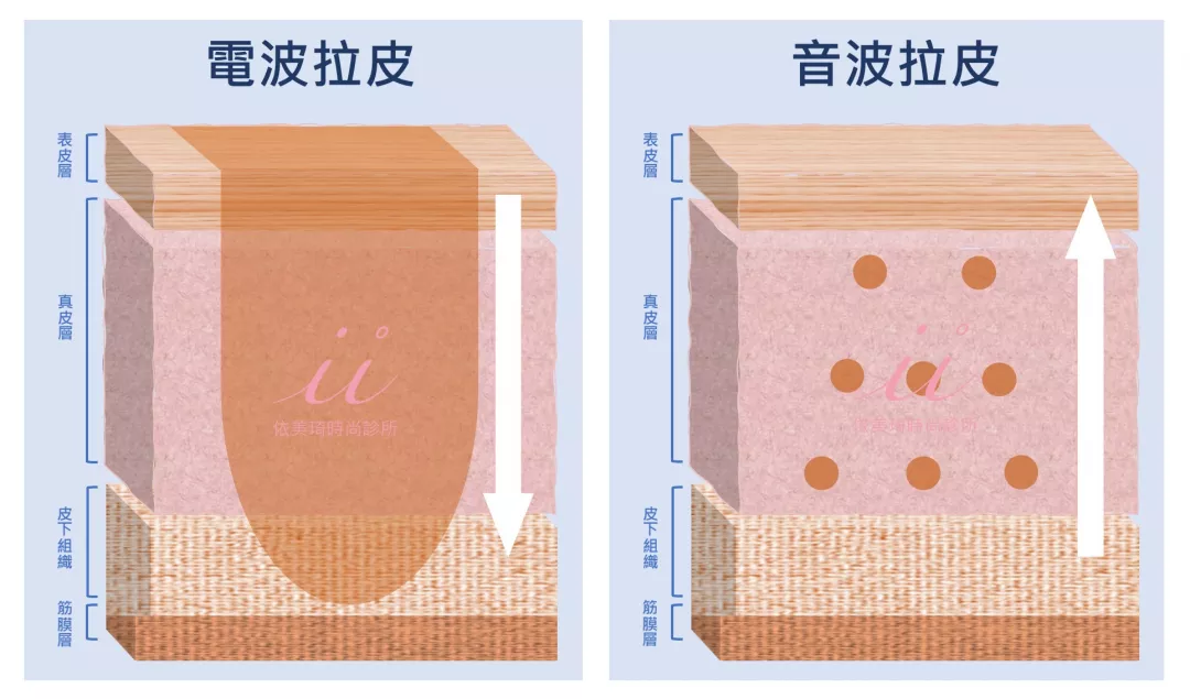 電波與音波的區別