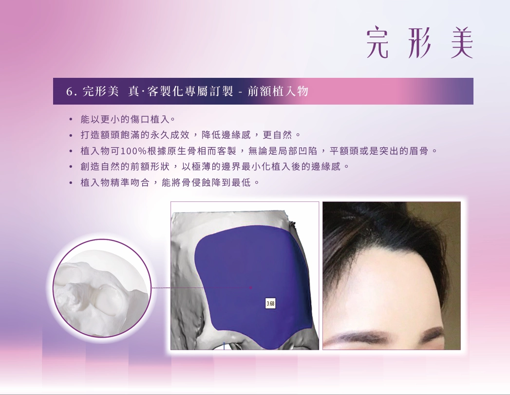額頭輪廓