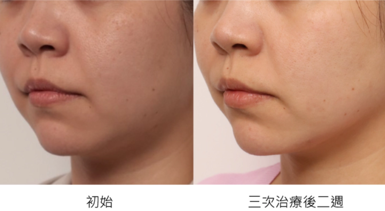 ONDA 實際案例