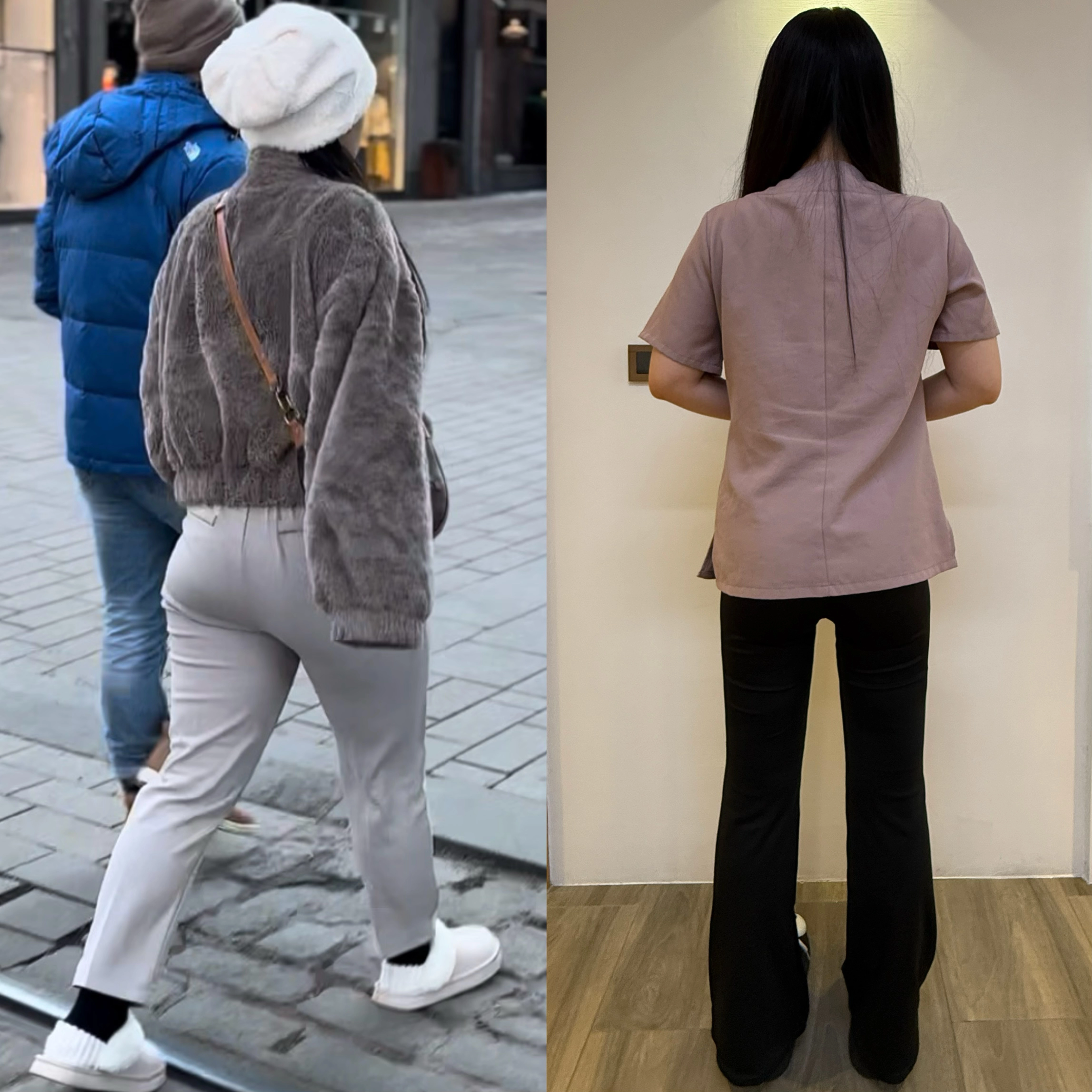 大腿抽脂術後對比