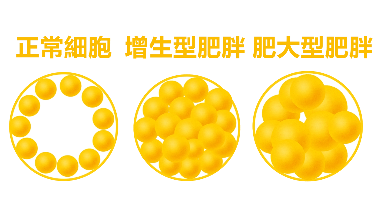 「增生型肥胖」是脂肪細胞數量增加，多發生在嬰兒期、青春期等生命早期，且一旦形成難以逆轉。而「肥大型肥胖」則是脂肪細胞體積增大，常見於成年人，透過飲食和運動相對較容易管理。