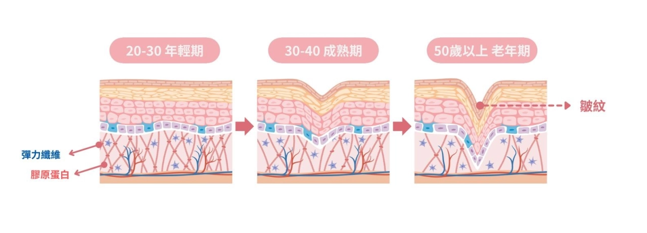 誰需要精靈針？皮膚老化過程