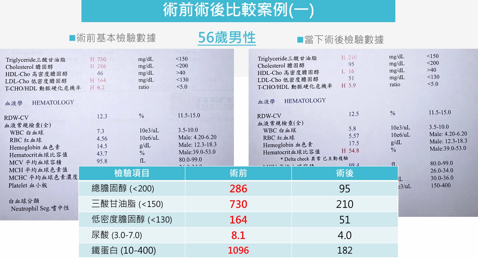 術前術後比較案例