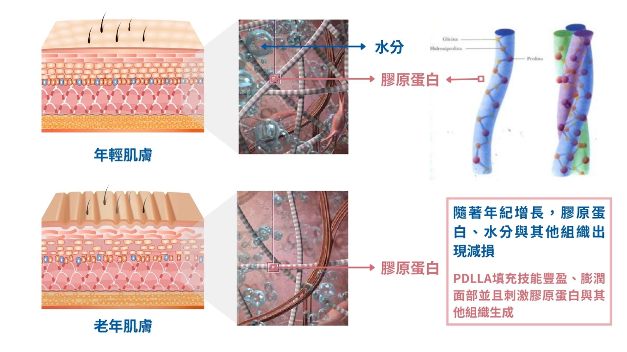 精靈針作用機制4