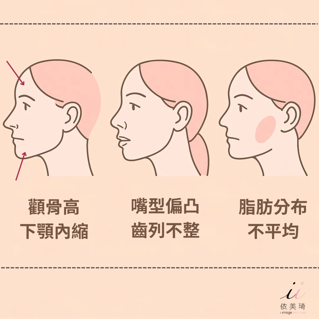法令紋是天生的嗎
