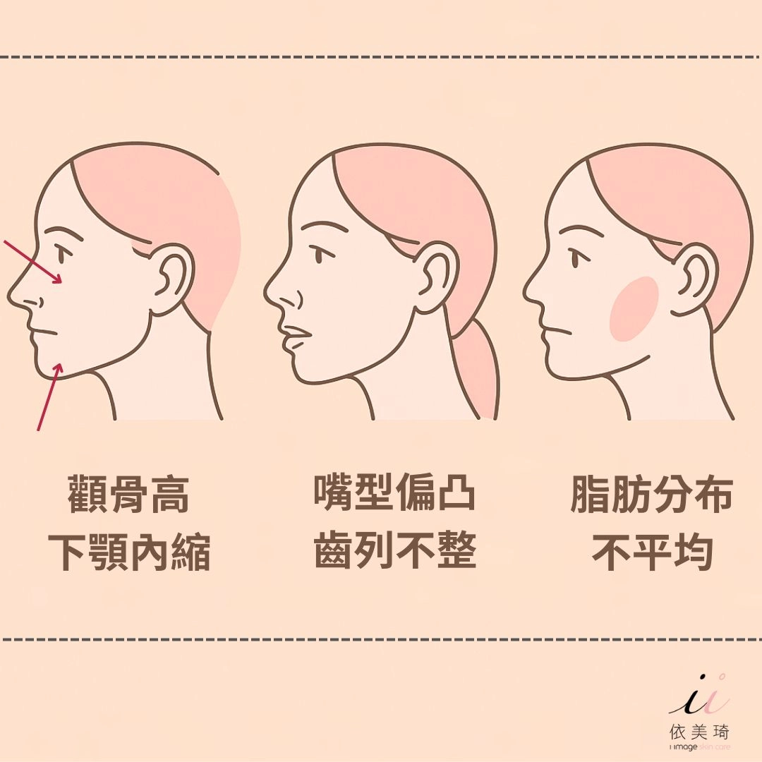 法令紋是天生的嗎