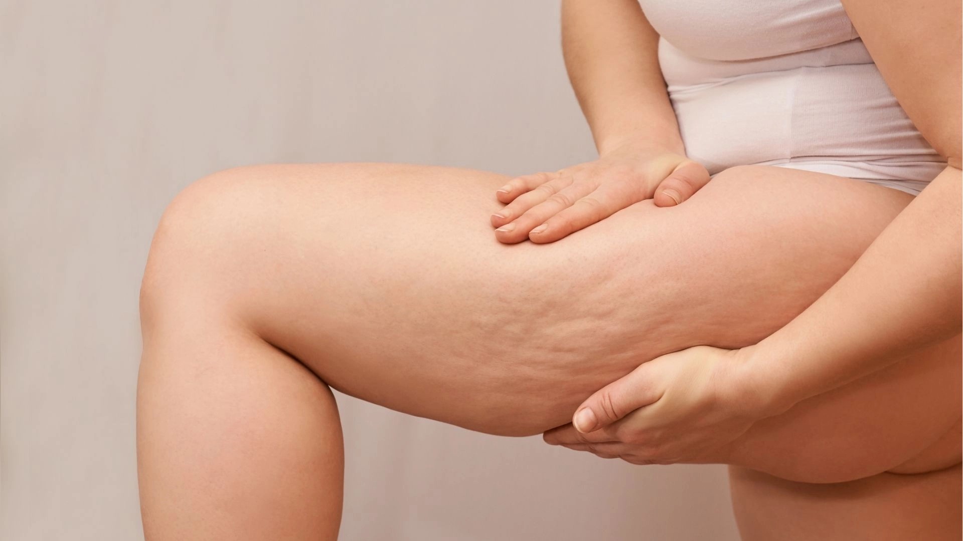 女生為什麼有橘皮?橘皮怎麼消除??醫美改善+日常對策一次看