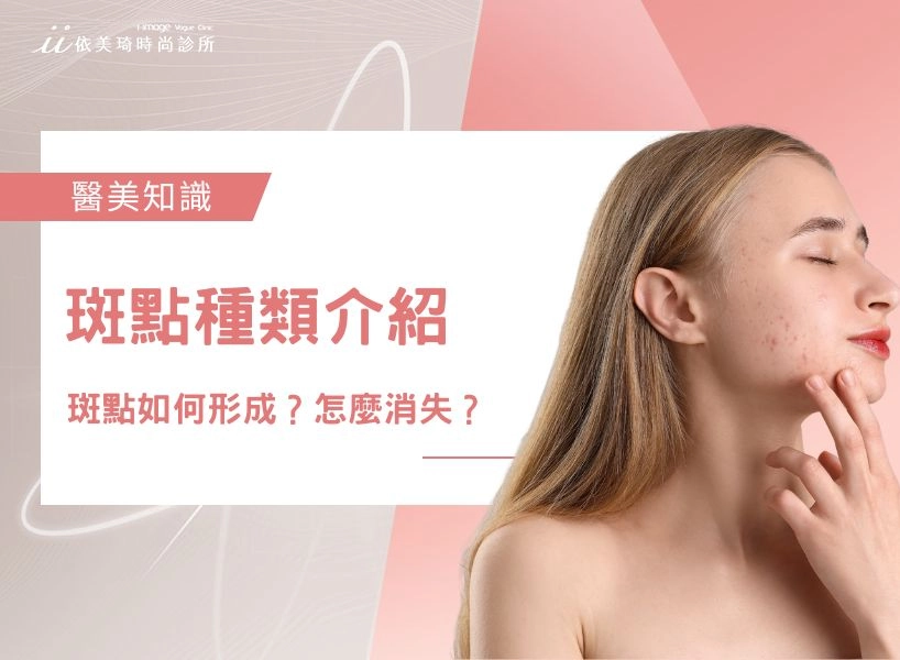 【斑點去除一次看】斑點種類介紹｜斑點如何形成？斑點怎麼消失？