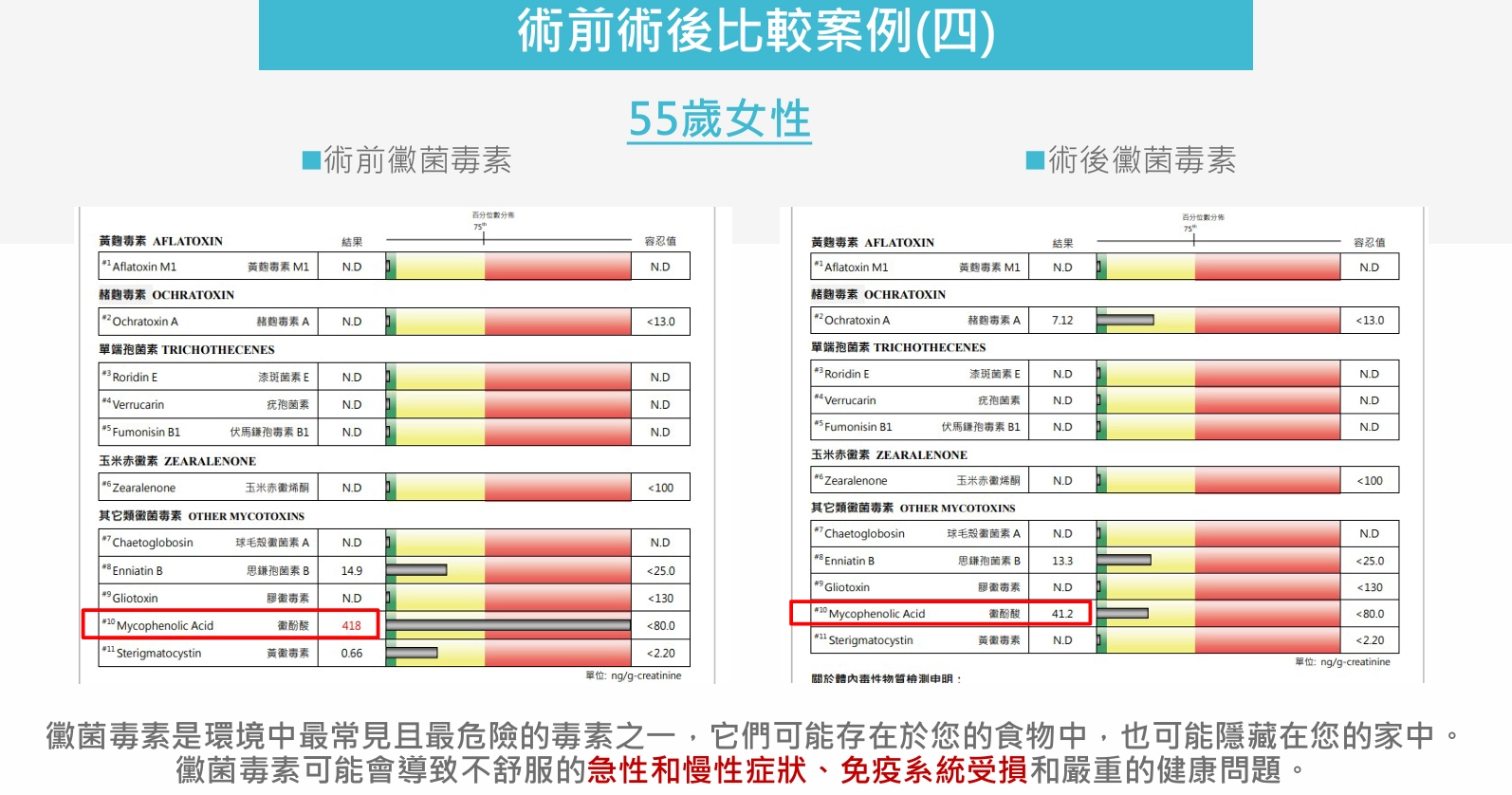 術前術後比較案例