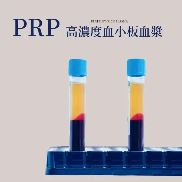 PRP (Platelet-Rich Plasma) 高濃度血小板血漿技術