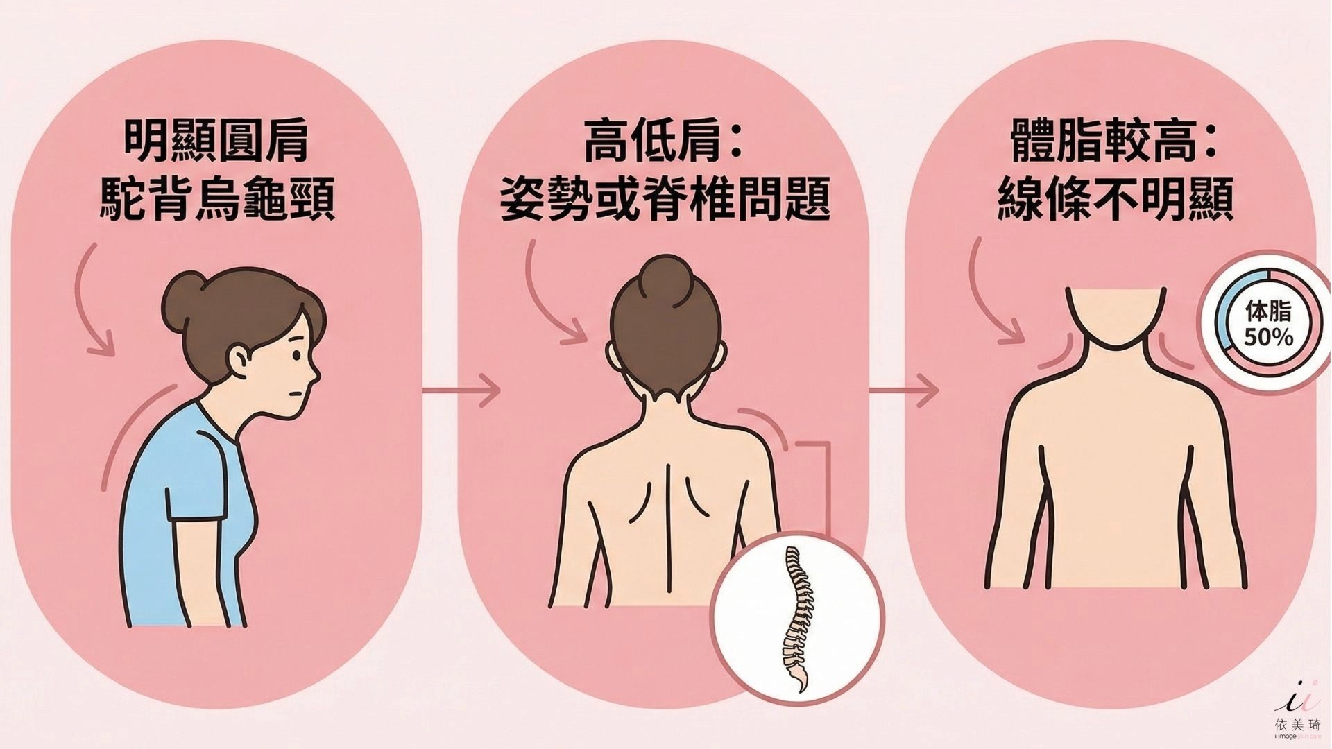 不一定只靠肉毒就能改善的人