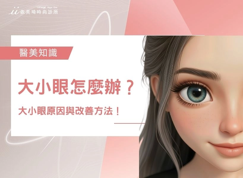 大小眼怎麼辦？大小眼原因？醫師教你怎樣改善大小眼！	