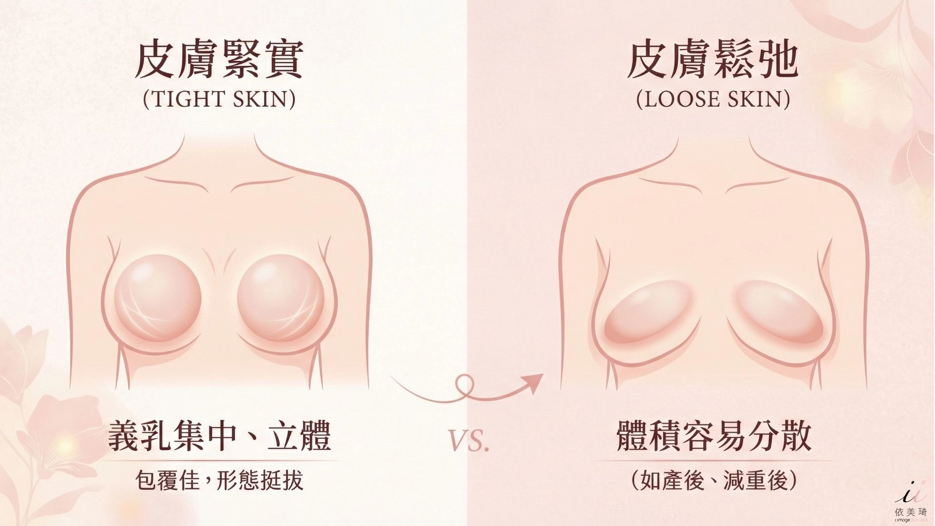 皮膚與組織彈性