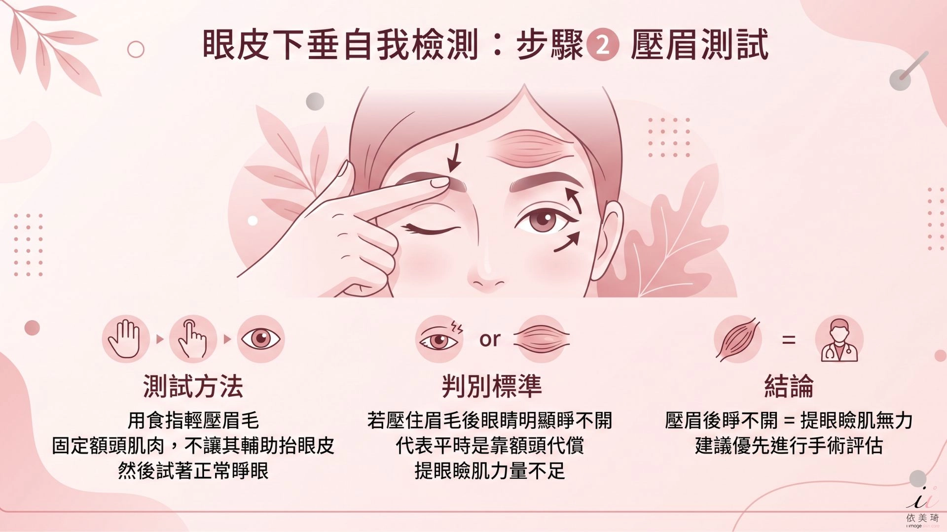 壓眉測試：用食指輕壓眉毛，把額頭肌肉固定住，不讓它幫忙抬眼皮。然後試著正常睜眼。