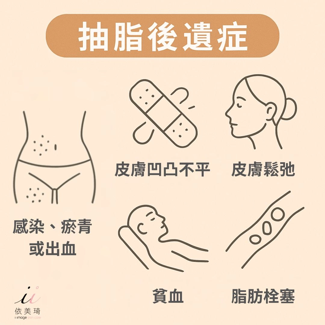 抽脂後遺症有哪些