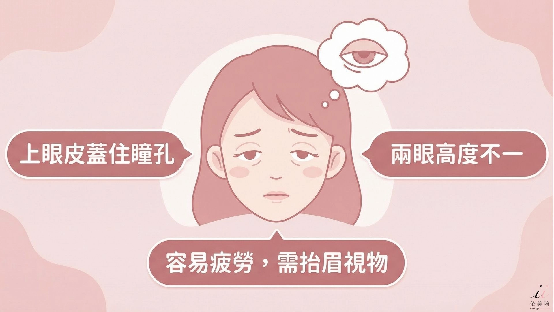 眼皮下垂常見特徵