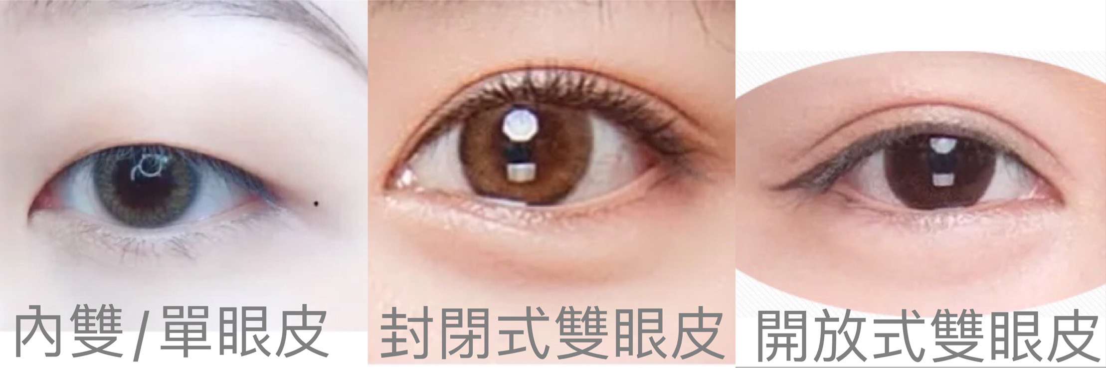 常見眼皮種類
