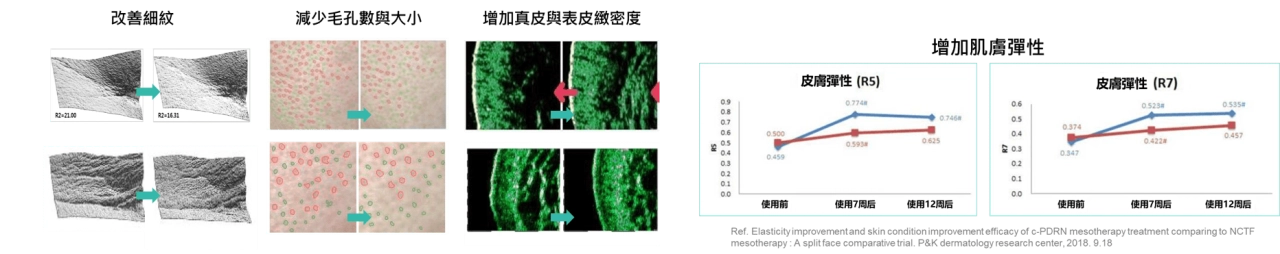 這款產品特別適合因膠原蛋白流失而膚質鬆弛的族群,以及希望改善毛孔粗大、預防老化的愛美人士,為肌膚提供多層次的修復與保養效果。