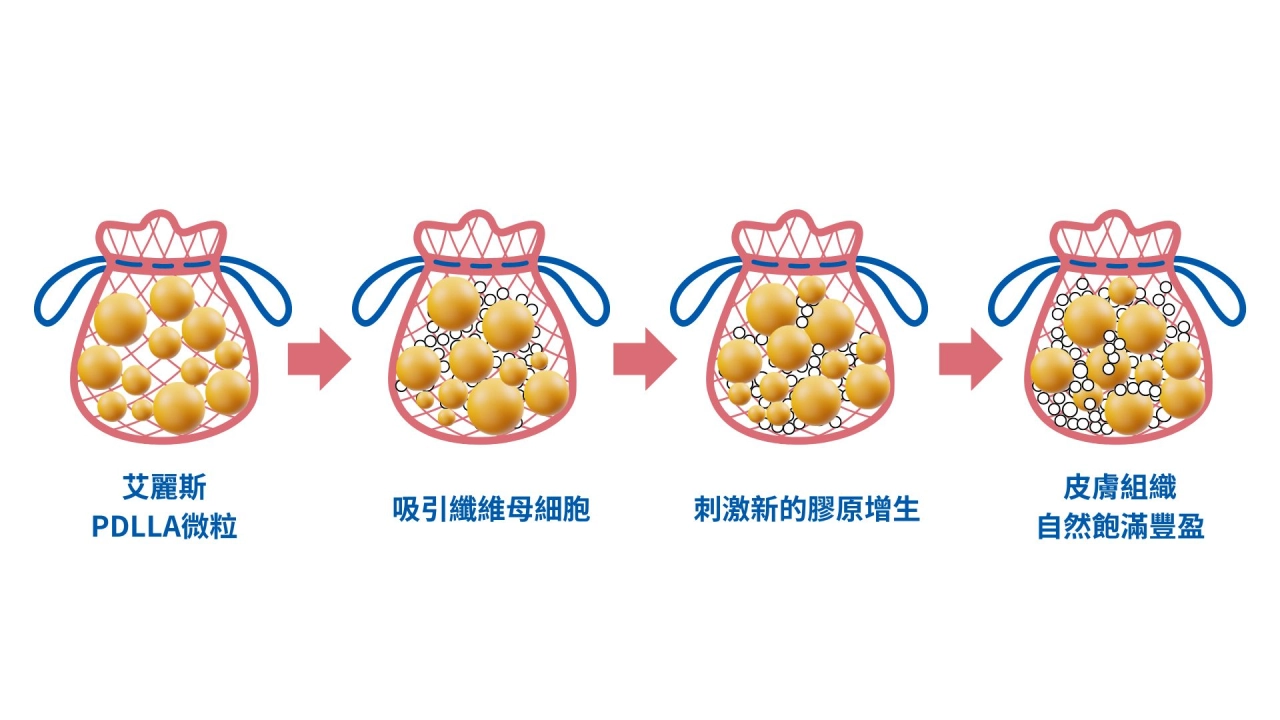 精靈針作用機制2