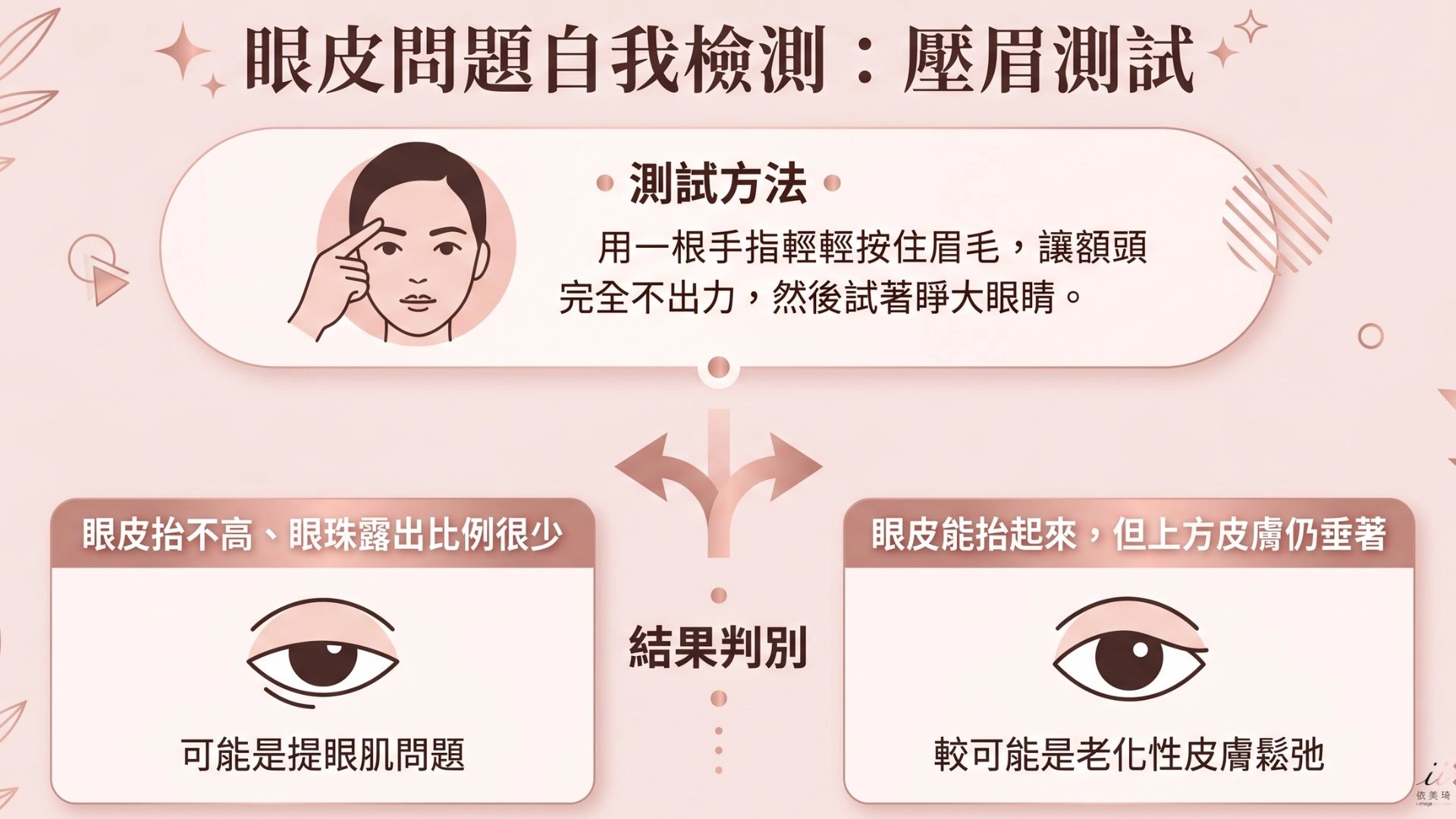 自我判斷小測試，用一根手指輕輕按住眉毛，讓額頭完全不出力，然後試著睜大眼睛