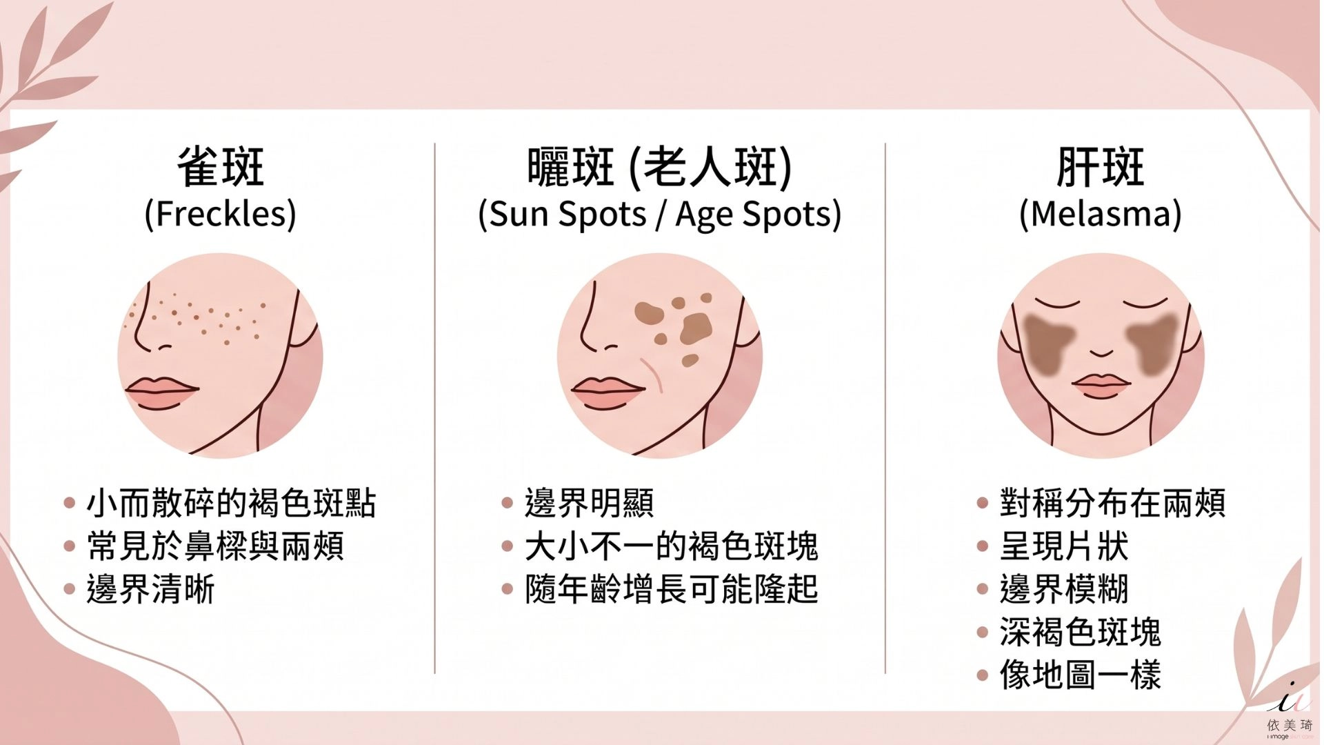雀斑 vs 曬斑 vs 肝斑差在哪