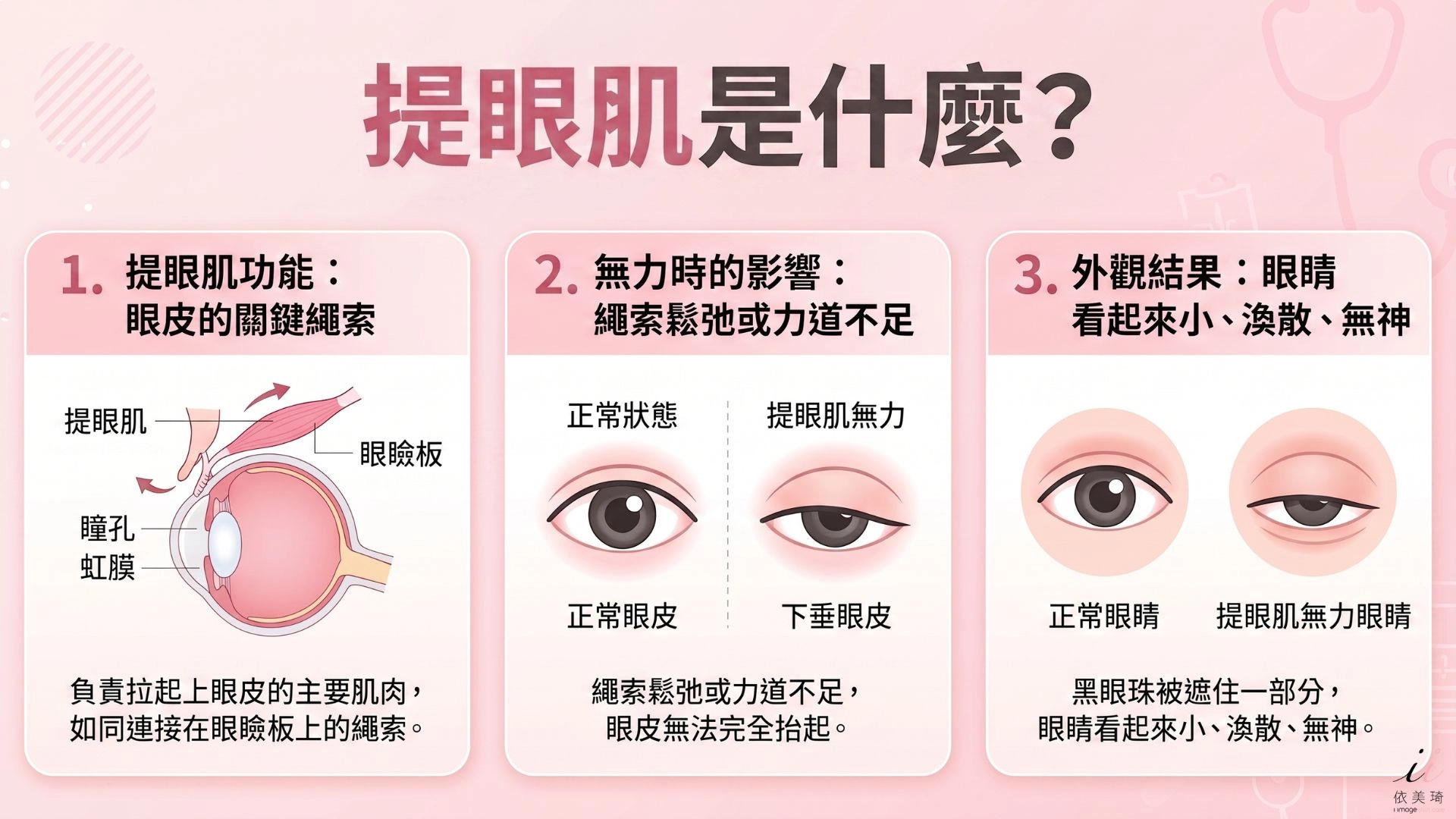 提眼肌（ Levator Palpebrae Superioris ）是負責拉起上眼皮的主要肌肉，就像一條連接在眼瞼板上的繩索。