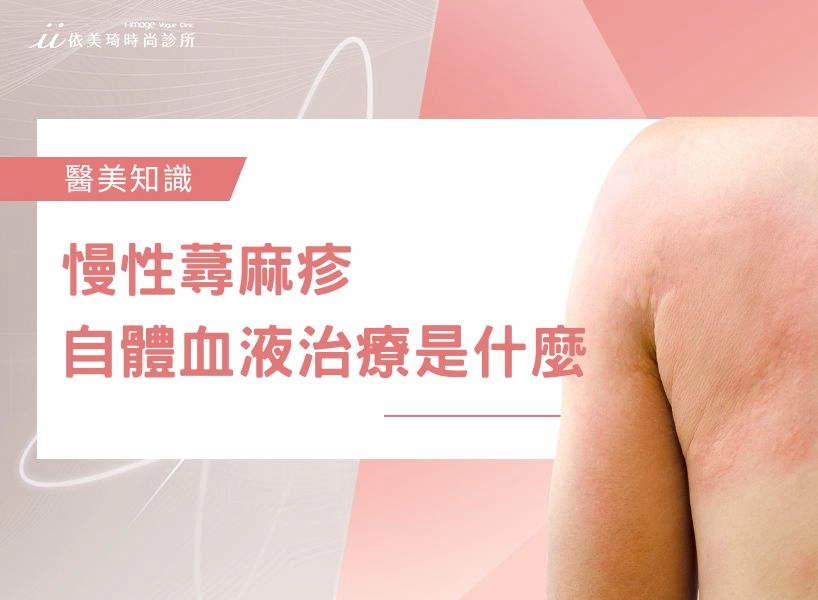 慢性蕁麻疹自體血液治療（AWBI）是什麼？原理、效果、次數、費用一次看懂