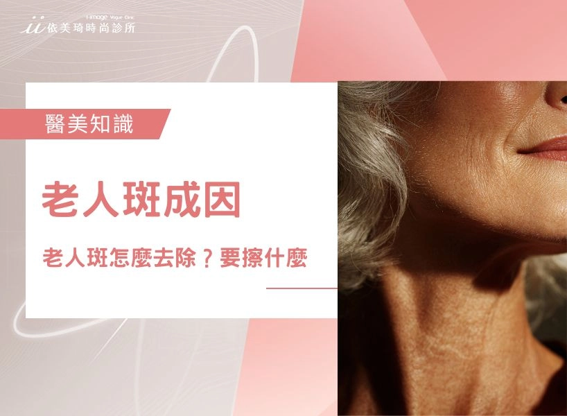 老人斑成因：老人斑怎麼去除？老人斑要擦什麼？