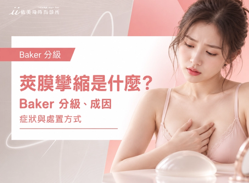 莢膜攣縮是什麼？了解 Baker 分級、成因、症狀與處置方式