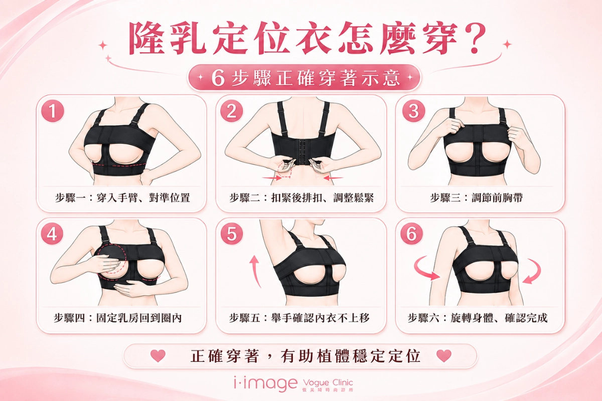 breast-augmentation-compression-garment-duration2