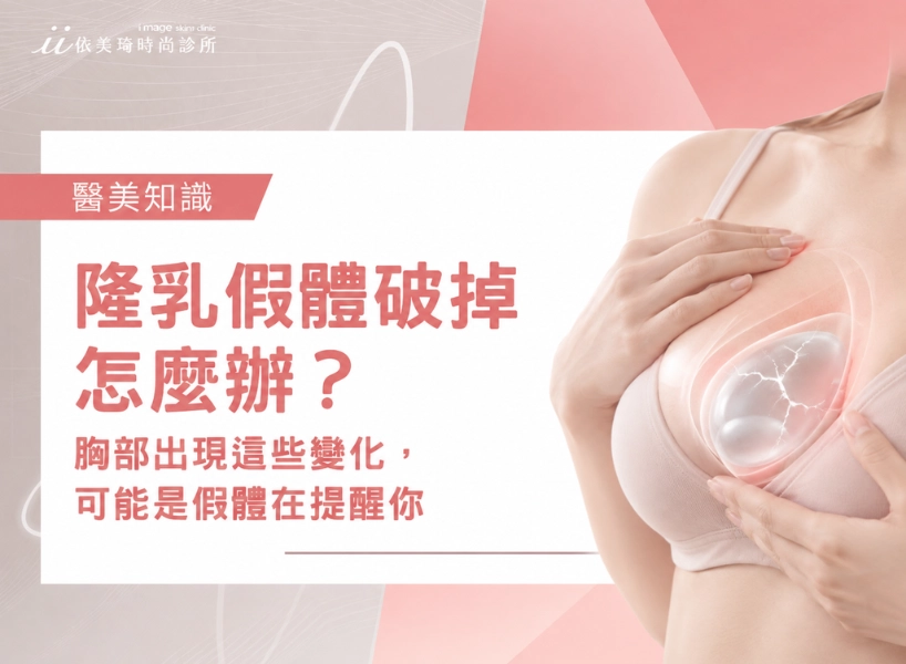 隆乳假體破掉怎麼辦？胸部出現這些變化，可能是假體在提醒你